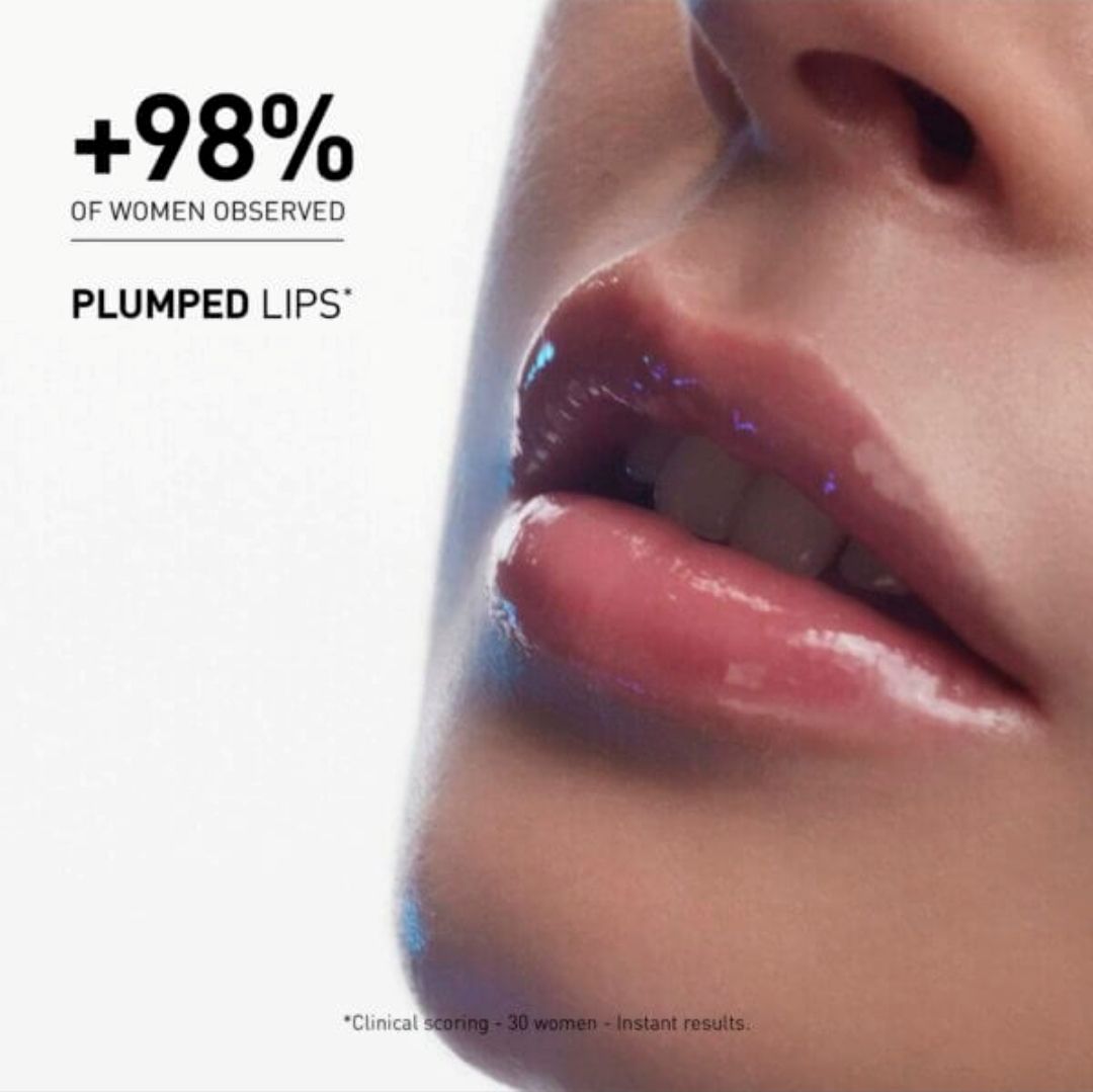 Hyalu Filler Lips 06.jpg