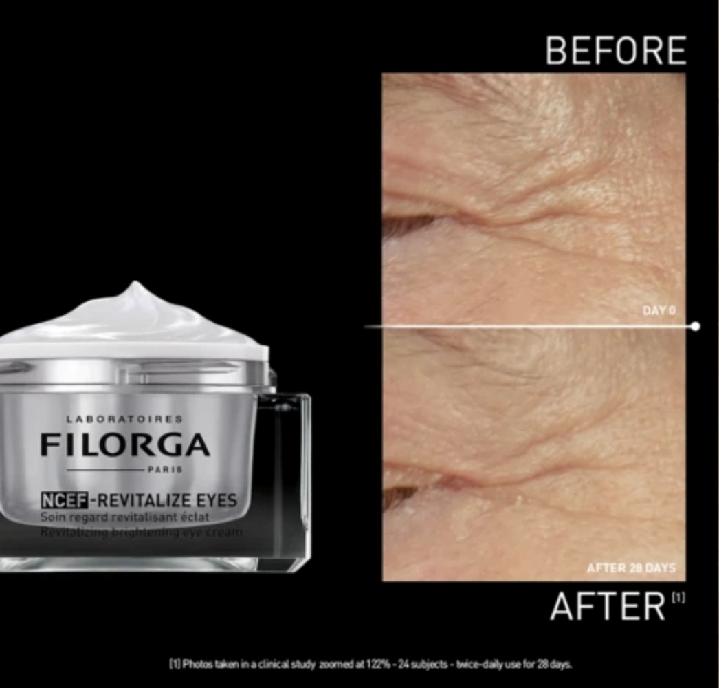 NCEF Revitalize Eyes 05.jpg