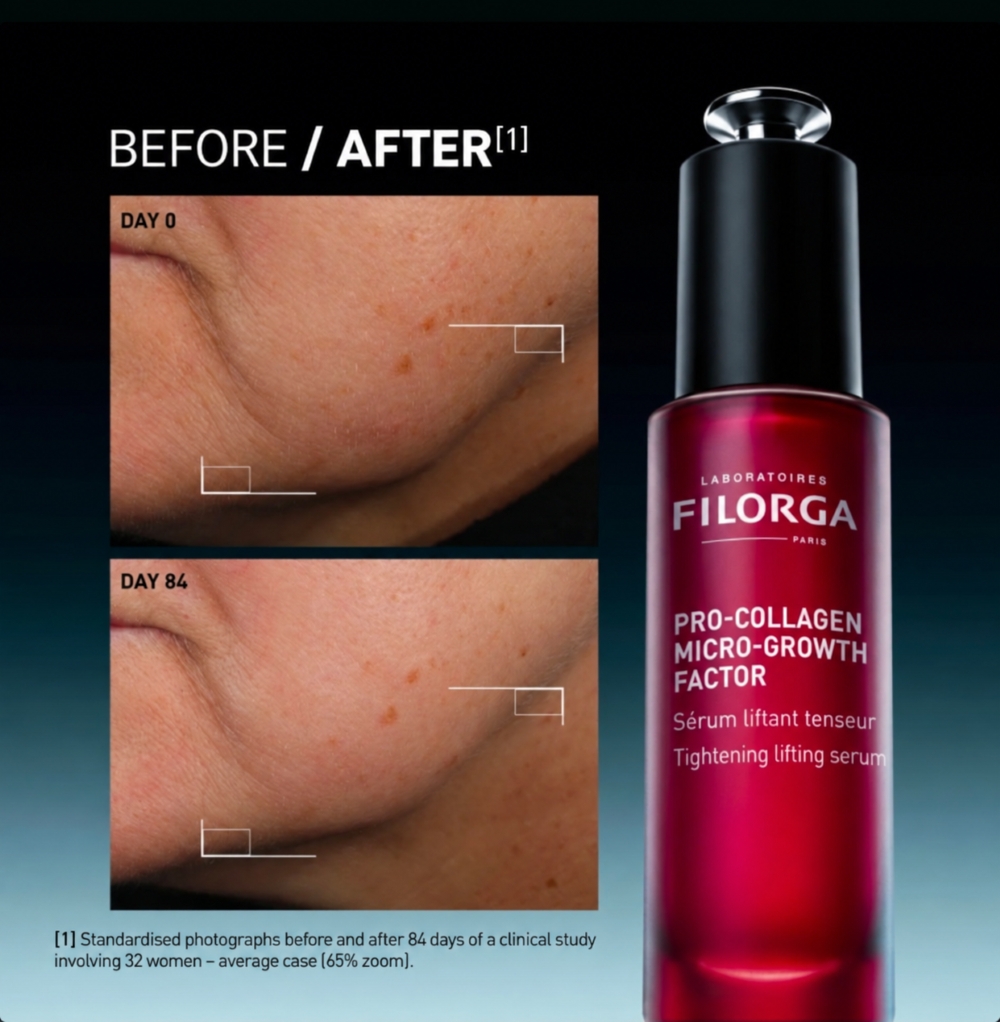 Filorga Pro-Collagen Micro-Growth Factor Serum before and after 84 days
